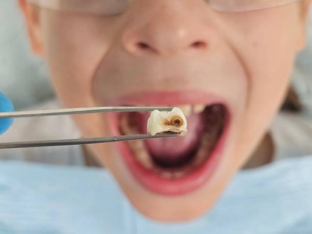Best Holiday Emergency Dentist in Lewisville, WA